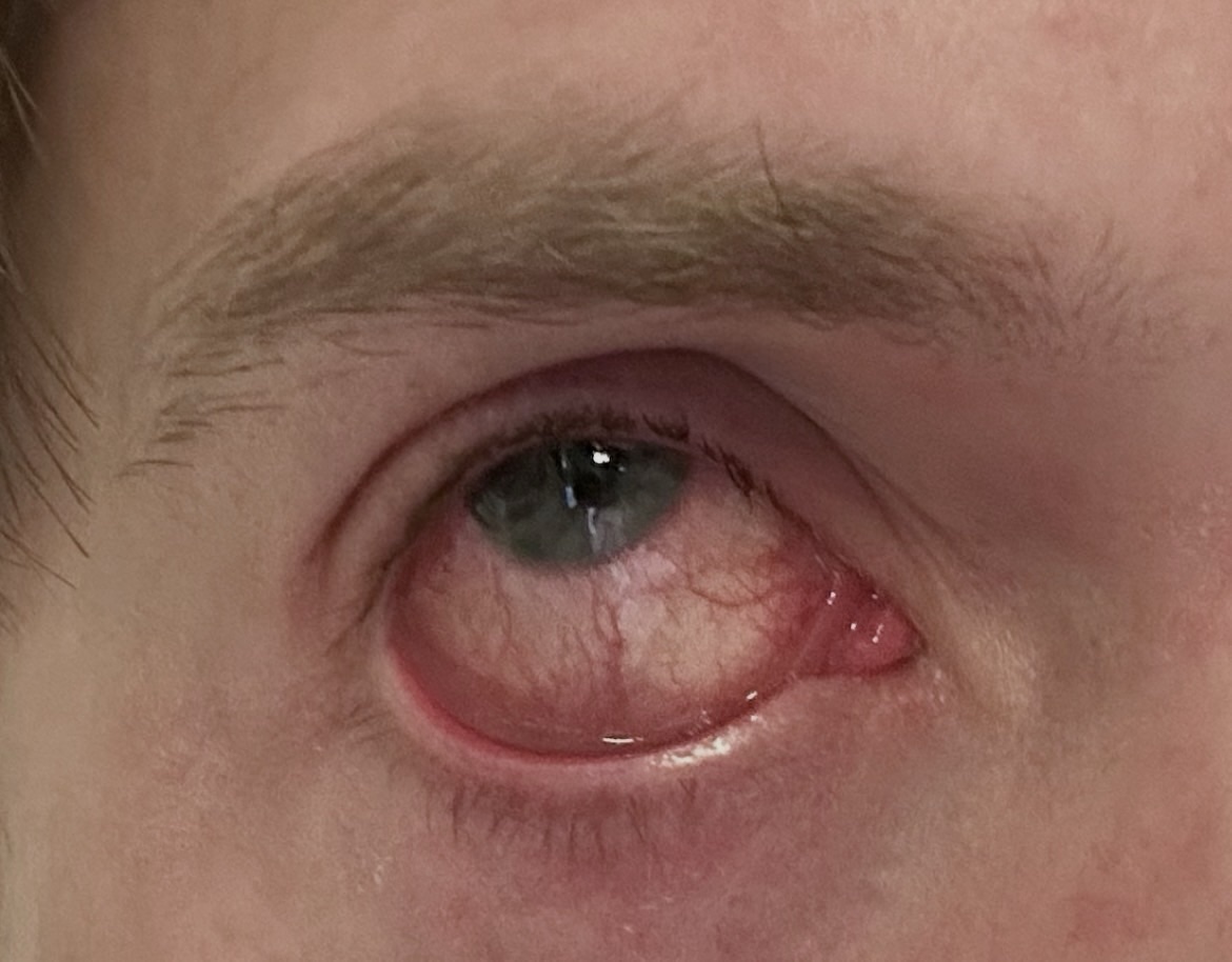 Sick and T-Eye-Red.